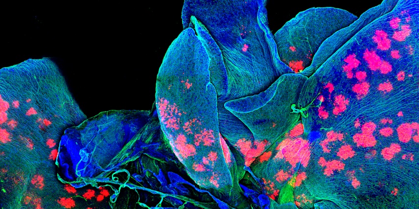 fluorescent microscopy image of nanoparticles in lung tissue